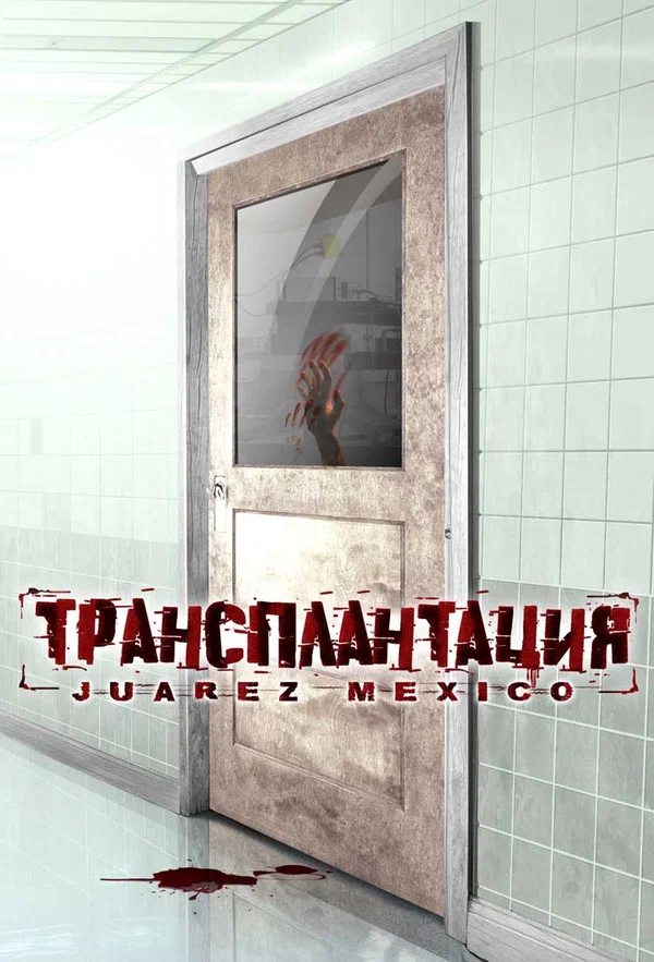 Постер: Трансплантация