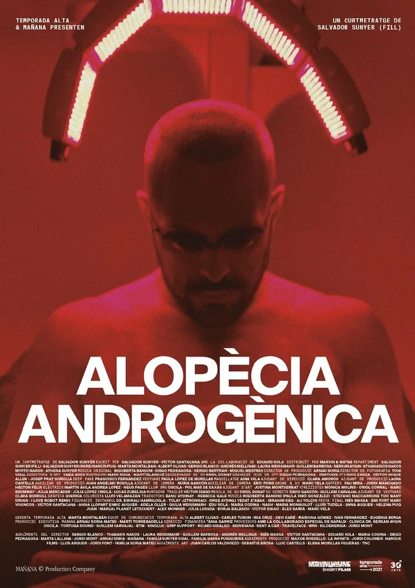 Постер: Alopècia androgènica