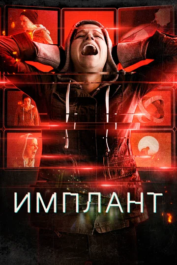 Постер: Имплант