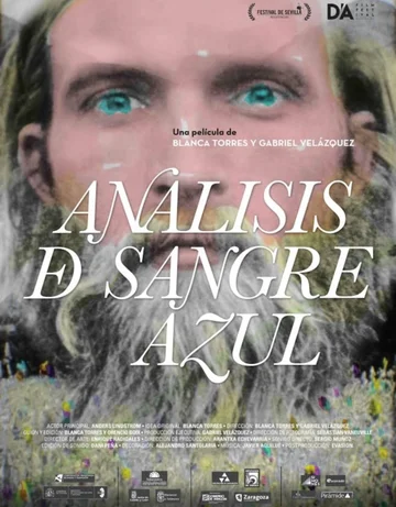 Постер: Análisis de sangre azul