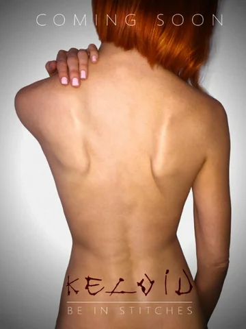 Постер: Keloid