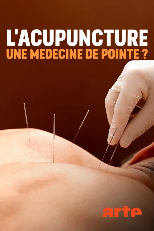 Постер: Spitzenmedizin: Akupunktur - Mythos oder Therapie?