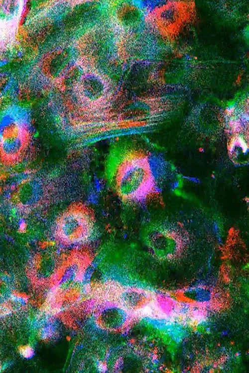Постер: Wound