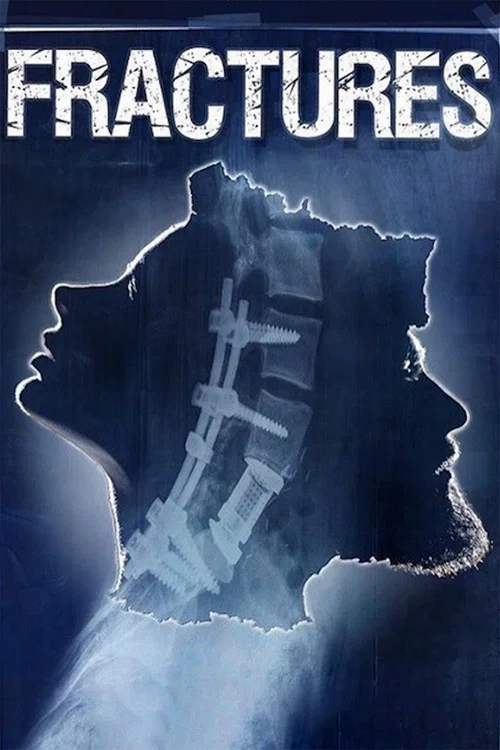 Постер: Fractures