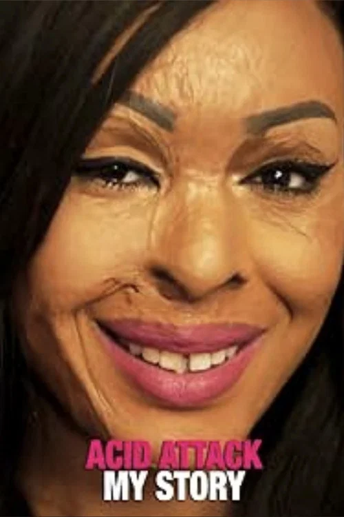 Постер: Acid Attack: My Story