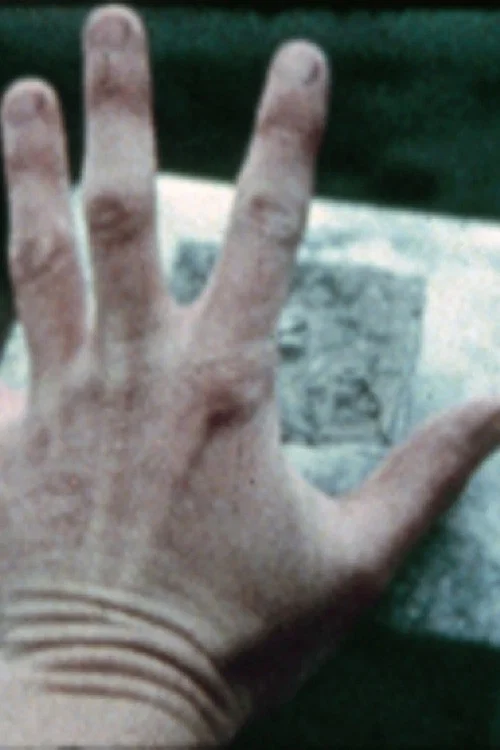 Постер: Barbara Ward Will Never Die
